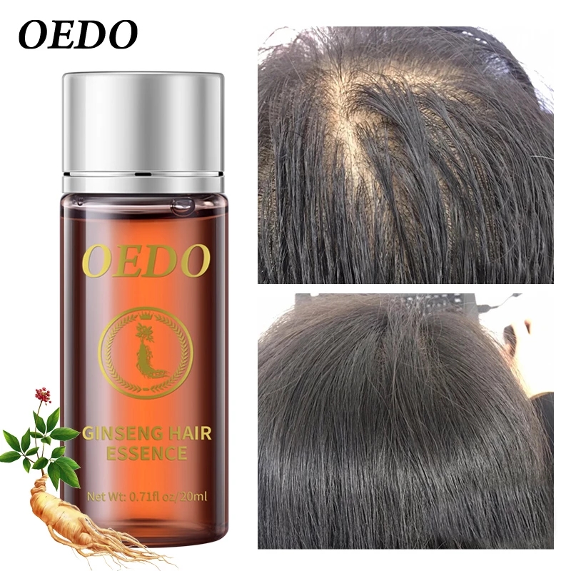 20ML Ginseng Essenza per la cr - Ginger Tea recensione e prezzo