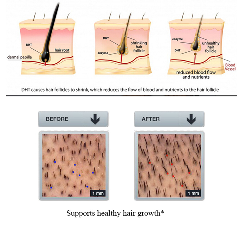 PURC Shampoo per la perdita de - Licorice Root Sticks recensione e prezzo